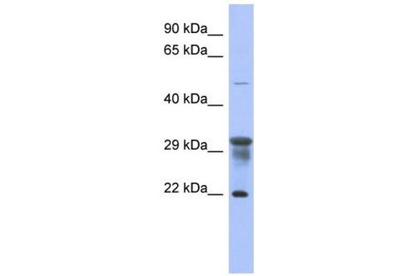 anti-Phosphomannomutase 1 (PMM1) (N-Term) antibody