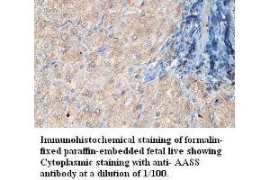 Image no. 1 for anti-Aminoadipate Semialdehyde Synthase (AASS) antibody (ABIN6583906)
