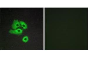 Image no. 2 for anti-Chemokine Binding Protein 2 (CCBP2) (AA 335-384) antibody (ABIN1535577)