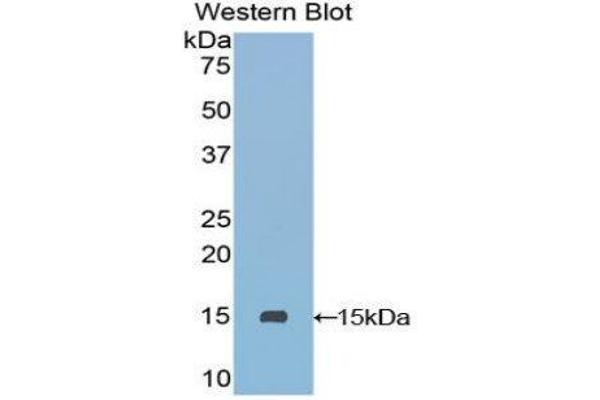 anti-Secreted LY6/PLAUR Domain Containing 1 (SLURP1) (AA 1-103) antibody