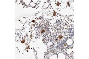 Image no. 1 for anti-Myotubularin Related Protein 11 (MTMR11) antibody (ABIN5583891)