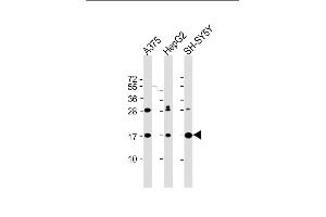 All lanes : Anti-SRP14 Antibody (Center) at 1:2000 dilution Lane 1:  whole cell lysate Lane 2: HepG2 whole cell lysate Lane 3: SH-SY5Y whole cell lysate Lysates/proteins at 20 μg per lane.