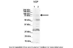 Image no. 2 for anti-Valosin Containing Protein (VCP) (C-Term) antibody (ABIN2788042)