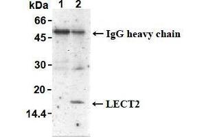 Image no. 1 for anti-Leukocyte Cell-Derived Chemotaxin 2 (LECT2) antibody (ABIN1108032)