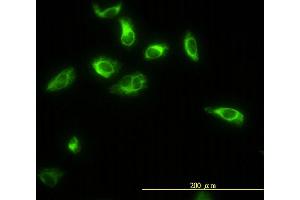 Immunofluorescence of monoclonal antibody to TPMT on HeLa cell.