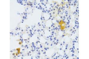 Immunohistochemistry of paraffin-embedded Mouse lung using FAS Polyclonal Antibody at dilution of 1:100 (40x lens).