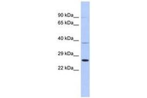 Image no. 1 for anti-SAR1 Homolog B (SAR1B) (AA 107-156) antibody (ABIN6744023)