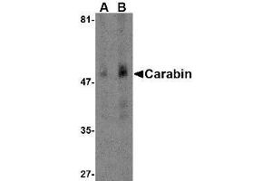 Carabin Antikörper  (N-Term)