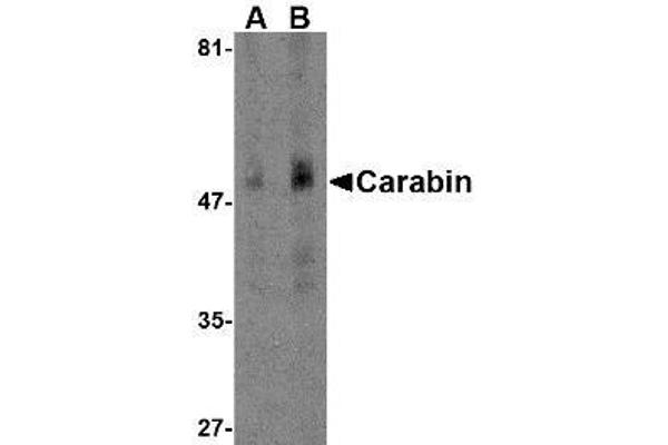Carabin 抗体  (N-Term)
