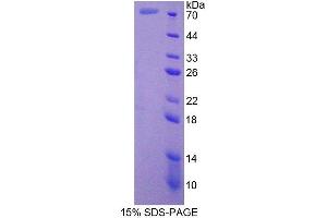 Image no. 1 for Cortactin (CTTN) (AA 1-509) protein (T7 tag,His tag) (ABIN6238524)