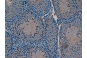 Image no. 2 for anti-V-Rel Reticuloendotheliosis Viral Oncogene Homolog B (RELB) (AA 176-436) antibody (ABIN1860430)