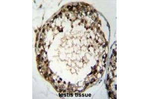 Image no. 3 for anti-Testis Specific Serine Kinase 4 (TSSK4) (AA 233-262), (C-Term) antibody (ABIN955364)