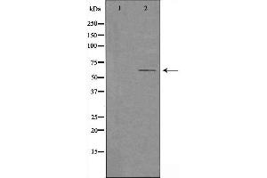 anti-Cytochrome P450, Family 2, Subfamily U, Polypeptide 1 (CYP2U1) (Internal Region) antibody