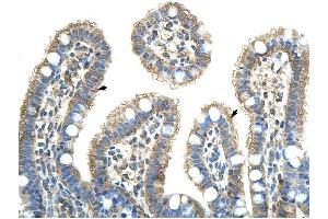 Image no. 2 for anti-Nuclear RNA Export Factor 5 (NXF5) (Middle Region) antibody (ABIN629931)