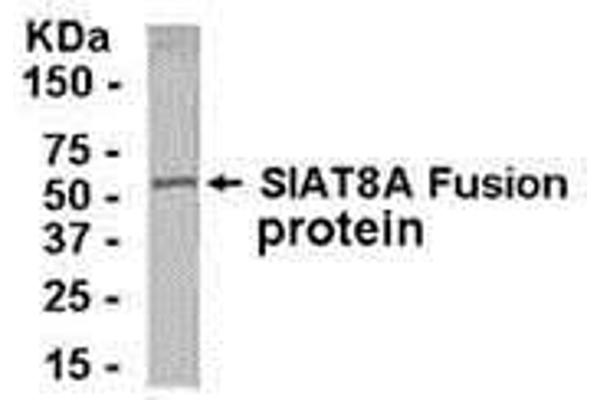 anti-ST8 alpha-N-Acetyl-Neuraminide alpha-2,8-Sialyltransferase 1 (ST8SIA1) (AA 4-18) antibody