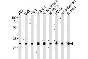 Image no. 1 for anti-Phosphatidylinositol Transfer Protein, alpha (PITPNA) (AA 243-270), (C-Term) antibody (ABIN1881656)
