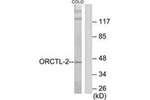 Image no. 1 for anti-Solute Carrier Family 22 Member 18 (SLC22A18) (AA 359-408) antibody (ABIN1534063)