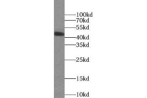 Image no. 2 for anti-Orosomucoid 2 (ORM2) antibody (ABIN5873444)