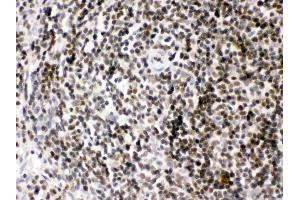 Image no. 3 for anti-High Mobility Group Box 2 (HMGB2) (AA 65-97), (N-Term) antibody (ABIN4886620)