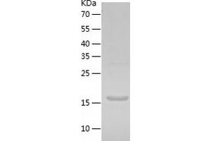 K-RAS Protein (AA 1-186) (His tag)