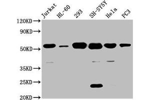 Western Blot Positive WB detected in: Jurkat whole cell lysate, HL60 whole cell lysate, 293 whole cell lysate, SH-SY5Y whole cell lysate, Hela whole cell lysate, PC-3 whole cell lysate All lanes: CYP21A2 antibody at 8 μg/mL Secondary Goat polyclonal to rabbit IgG at 1/50000 dilution Predicted band size: 56, 53 kDa Observed band size: 56 kDa