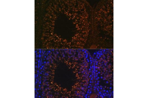 LDHAL6B antibody  (AA 1-80)