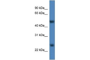 Image no. 1 for anti-Methyltransferase Like 4 (METTL4) (C-Term) antibody (ABIN2773931)