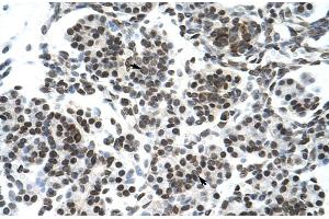 Rabbit Anti-ZNF394 Antibody Catalog Number: ARP30072 Paraffin Embedded Tissue: Human Pancreas Cellular Data: Epithelial cells of pancreatic acinus Antibody Concentration: 4.