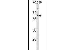 KLHL14 Antibody (Center) (ABIN1538386 and ABIN2849976) western blot analysis in  cell line lysates (35 μg/lane).