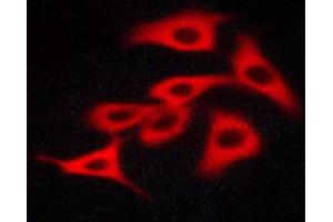 Image no. 8 for anti-Mast/stem Cell Growth Factor Receptor (KIT) (pTyr703) antibody (ABIN6255994)