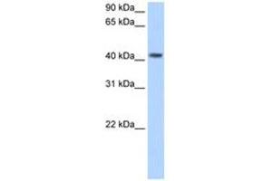 PSG5 anticorps  (AA 71-120)