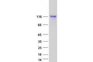 Image no. 1 for Calpastatin (CAST) (Transcript Variant 10) protein (Myc-DYKDDDDK Tag) (ABIN2713065)