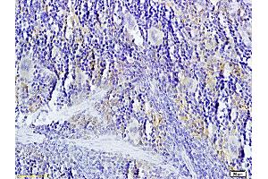 Image no. 1 for anti-Tumor Necrosis Factor (Ligand) Superfamily, Member 14 (TNFSF14) (AA 141-240) antibody (ABIN740625)