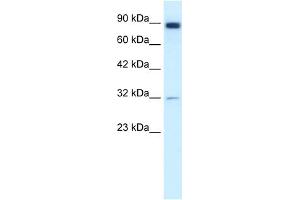 Image no. 1 for anti-Matrix Metallopeptidase 9 (Gelatinase B, 92kDa Gelatinase, 92kDa Type IV Collagenase) (MMP9) (N-Term) antibody (ABIN2777743)