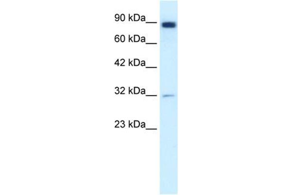 anti-Matrix Metallopeptidase 9 (Gelatinase B, 92kDa Gelatinase, 92kDa Type IV Collagenase) (MMP9) (N-Term) antibody