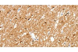 Immunohistochemistry of paraffin-embedded Human brain using AMZ1 Polyclonal Antibody at dilution of 1:80
