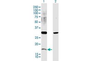 Image no. 1 for anti-CAMP Responsive Element Modulator (CREM) (AA 1-137) antibody (ABIN514590)
