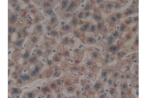 LGALS8 antibody  (AA 1-317)