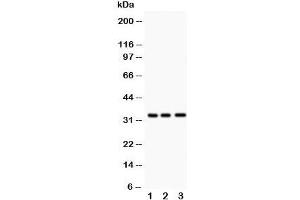 Western blot testing of MPG antibody and Lane 1:  rat liver;  2: human HeLa;  3: (h) Jurkat.