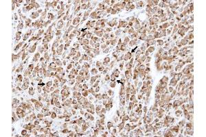Image no. 3 for anti-RELT Tumor Necrosis Factor Receptor (RELT) (Center) antibody (ABIN2855800)