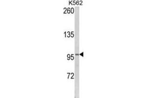 Image no. 1 for anti-Lipin 2 (LPIN2) antibody (ABIN3003814)
