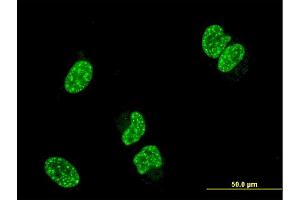 Immunofluorescence of monoclonal antibody to TP53RK on HeLa cell.