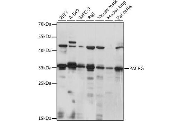 PACRG 抗体  (AA 150-250)