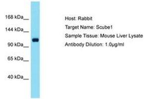 Image no. 1 for anti-Signal Peptide, CUB Domain, EGF-Like 1 (SCUBE1) (AA 518-567) antibody (ABIN6750516)