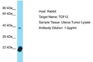 Image no. 1 for anti-Transcription Factor 12 (TCF12) (C-Term) antibody (ABIN2780488)