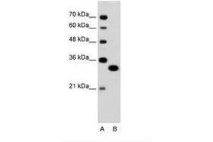 Image no. 1 for anti-Transcription Factor EC (TFEC) (AA 71-120) antibody (ABIN6736324)