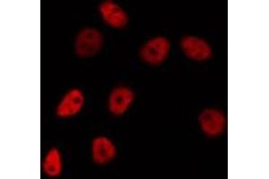 Image no. 2 for anti-FEV (ETS Oncogene Family) (FEV) antibody (ABIN6257177)