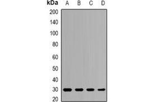 Image no. 3 for anti-Proteasome (Prosome, Macropain) Subunit, beta Type, 8 (Large Multifunctional Peptidase 7) (PSMB8) antibody (ABIN2966946)