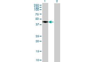 Image no. 1 for anti-RRS1 Ribosome Biogenesis Regulator (RRS1) (AA 1-365) antibody (ABIN525030)