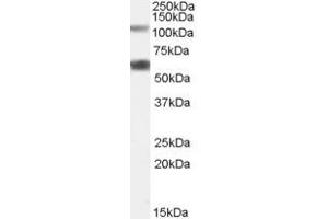 Image no. 6 for anti-O-Linked N-Acetylglucosamine (GlcNAc) Transferase (UDP-N-Acetylglucosamine:polypeptide-N-Acetylglucosaminyl Transferase) (OGT) (Internal Region) antibody (ABIN190863)